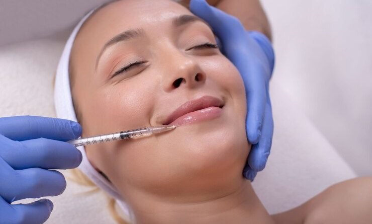 Preenchimento labial pode harmonizar o rosto de forma natural