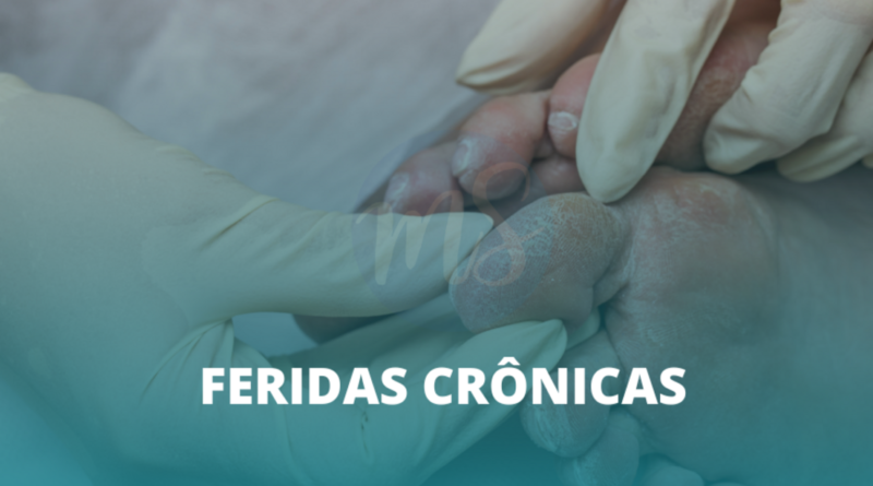 Estomaterapeuta trata ferida crônica e promove autocuidado eficaz