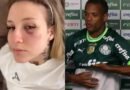 Ex-mulher do jogador Caio Paulista o acusa de agressões