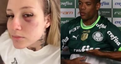 Ex-mulher do jogador Caio Paulista o acusa de agressões