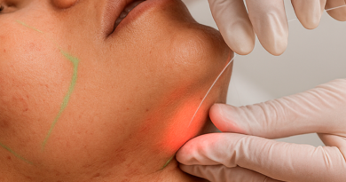 Laser subdérmico surge como alternativa à lipoaspiração