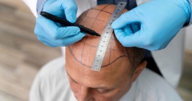 Clínica Artisti oferece tratamentos capilares personalizados