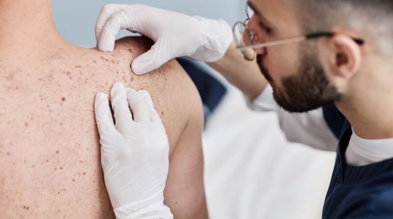 Desinformação e estigmas sobre a hanseníase atrasam cuidados