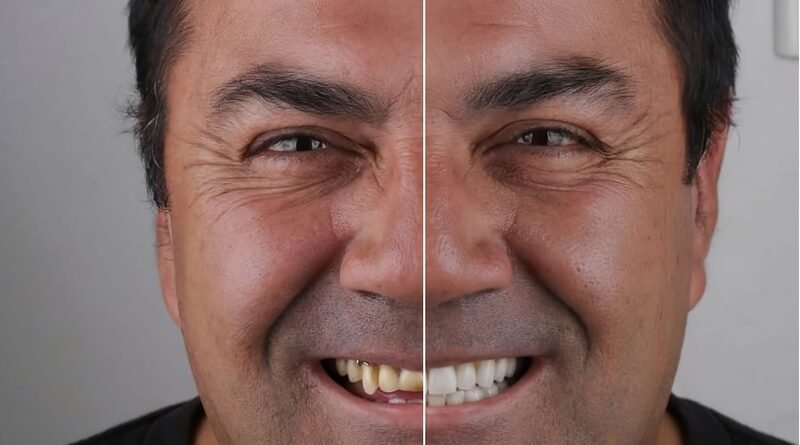 Tecnologia ajuda dentistas a prever resultados estéticos