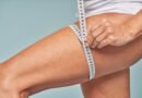 Lipedema exige avaliação clínica e tratamento personalizado