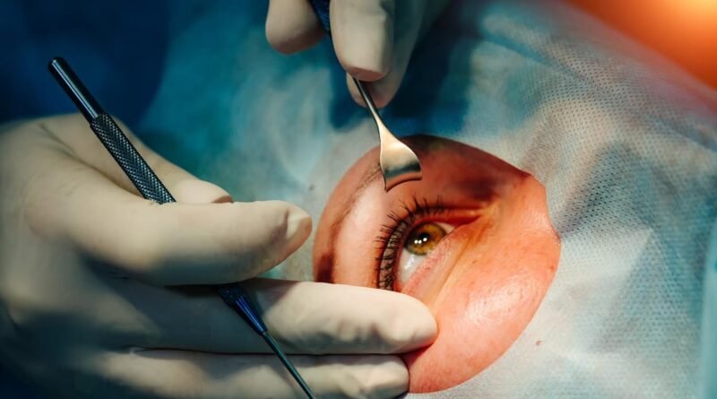 Cirurgia de catarata evolui e amplia recuperação da visão