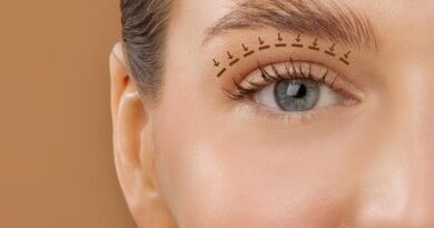 Blefaroplastia envolve função ocular além da estética