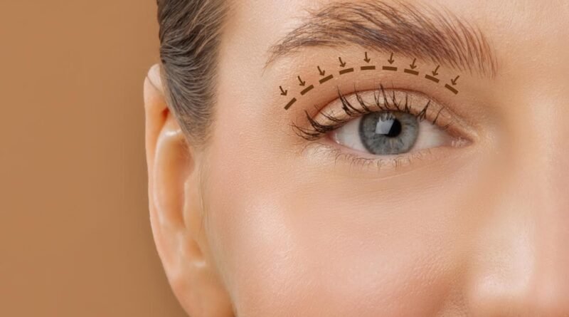 Blefaroplastia envolve função ocular além da estética