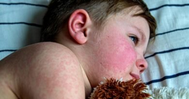 Queda da cobertura vacinal gera alerta para volta do sarampo