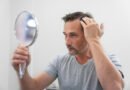 Tratamentos ampliam alternativas para calvície masculina
