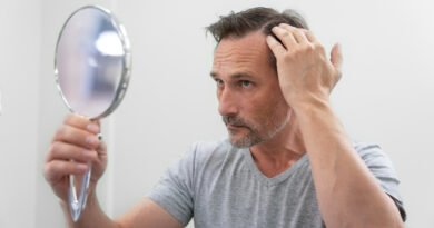 Tratamentos ampliam alternativas para calvície masculina