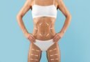 Avanços tecnológicos ampliam resultados da lipoaspiração