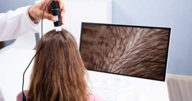 Tratamentos capilares ganham novas tecnologias