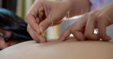 Acupuntura se consolida como prática terapêutica