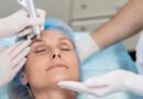 Blefaroplastia remodela pálpebras e rejuvenesce o olhar