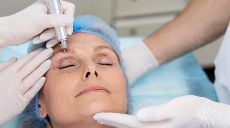 Blefaroplastia remodela pálpebras e rejuvenesce o olhar
