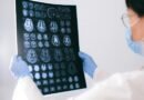 BrainAge: tecnologia indica a idade cerebral