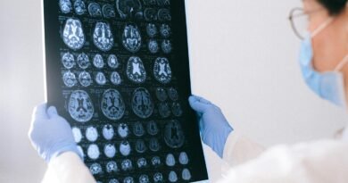 BrainAge: tecnologia indica a idade cerebral