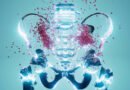 Cirurgia robótica amplia tratamento da endometriose