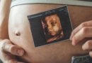 Ultrassonografia obstétrica avança no diagnóstico pré-natal