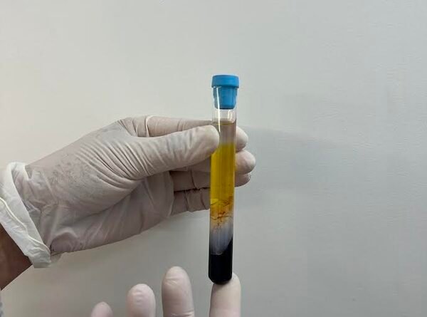 CFM regulamenta PRP em condições osteomusculares