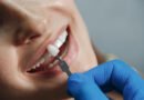 Falha em tratamento dentário nem sempre indica erro