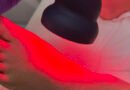 Laser de alta intensidade auxilia no controle da dor