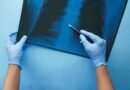 CONITEC abre consulta para Hipertensão Arterial Pulmonar