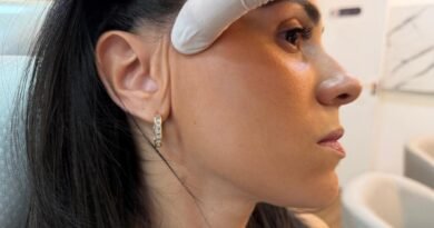 Lifting facial endoscópico dispensa cicatriz visível
