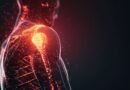 Novos procedimentos tratam a dor no ombro sem cirurgia