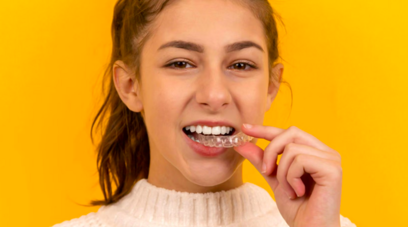 Alinhador invisível: como funciona o tratamento dentário