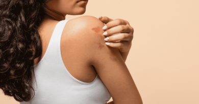 Mês da Dermatite Atópica: os impactos da doença na pele