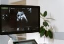Vilo corial tem diagnóstico genético precoce