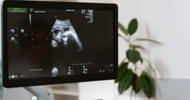 Vilo corial tem diagnóstico genético precoce