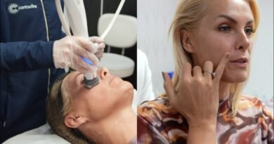 XERF conquista celebridades que buscam a renovação da beleza