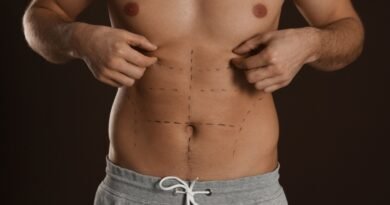 Definição em foco: a evolução da lipoaspiração masculina