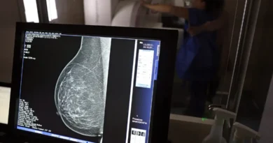 Brasília (DF), 01/10/2024 - Teste de mamografia realizado na Campanha Outubro Rosa: Sesc-DF, que oferece exames e consultas gratuitas às mulheres. Foto: José Cruz/Agência Brasil