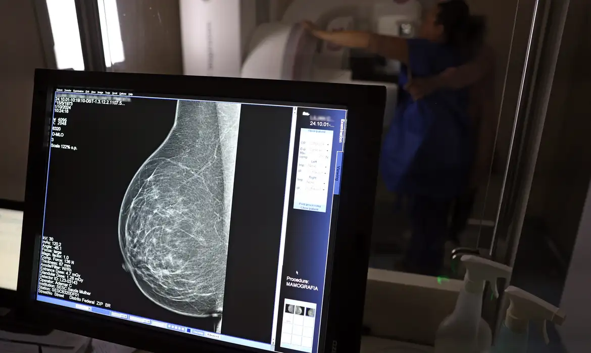Brasília (DF), 01/10/2024 - Teste de mamografia realizado na Campanha Outubro Rosa: Sesc-DF, que oferece exames e consultas gratuitas às mulheres. Foto: José Cruz/Agência Brasil