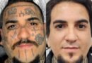 Remoção de tatuagem cresce e muda perfil de quem procura